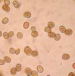 Agaric bisporé. Spores d'agaric bisporé colorées au rouge Congo SDS